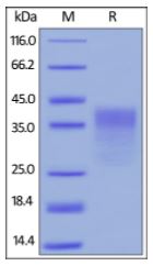 Human PD-1, His Tag (HPLC verified) on SDS-PAGE under reducing (R) condition. The gel was stained overnight with Coomassie Blue. The purity of the protein is greater than 95%.